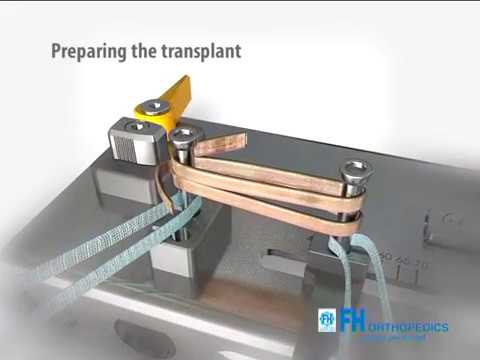 Tape Locking Screw (TLS)