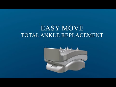EasyMove Total Ankle Replacement - Prothèse Totale de Cheville